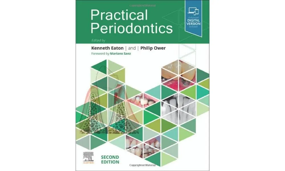 Practical Periodontics 2nd Edition (ISBN - 878456)