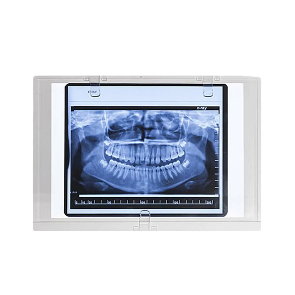 Sparedent Panoramic X-ray Viewer - Chair Mount