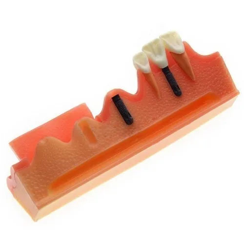 iDENTical Steps for Implant Model M2018