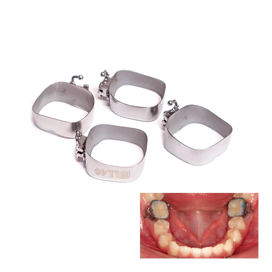 OSL 1st Molar Prewelded Molar Bands MBT 0.018 U2/L1 (Pack Of 4)