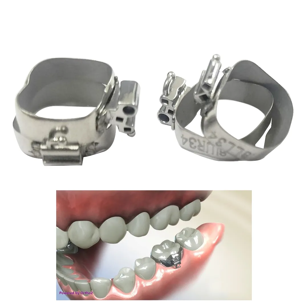 OSL 1st Molar Prewelded Molar Bands MBT 0.018 U3/L2 (Pack Of 4)