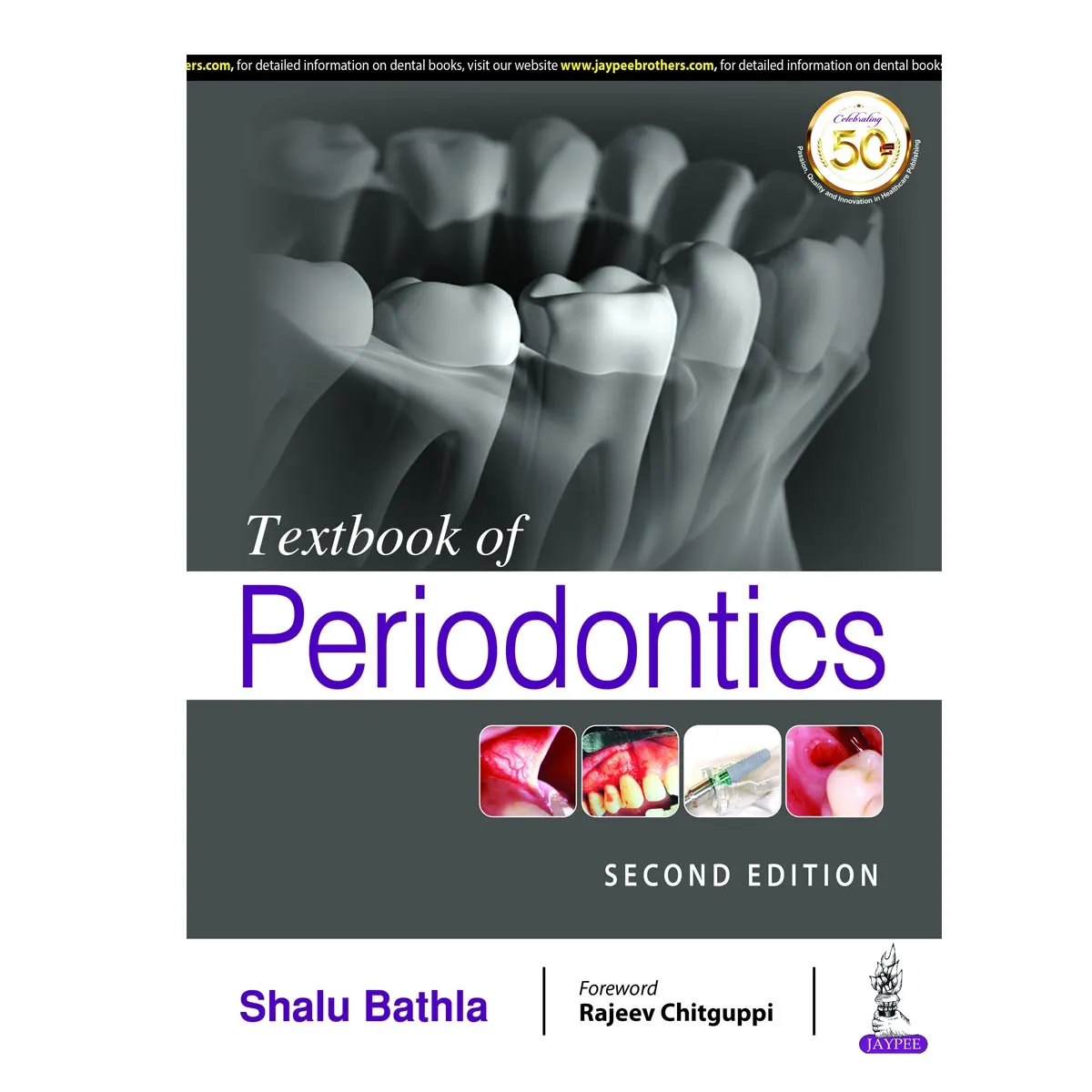 Jaypee Medical Textbook of Periodontics (ISBN - 595365)