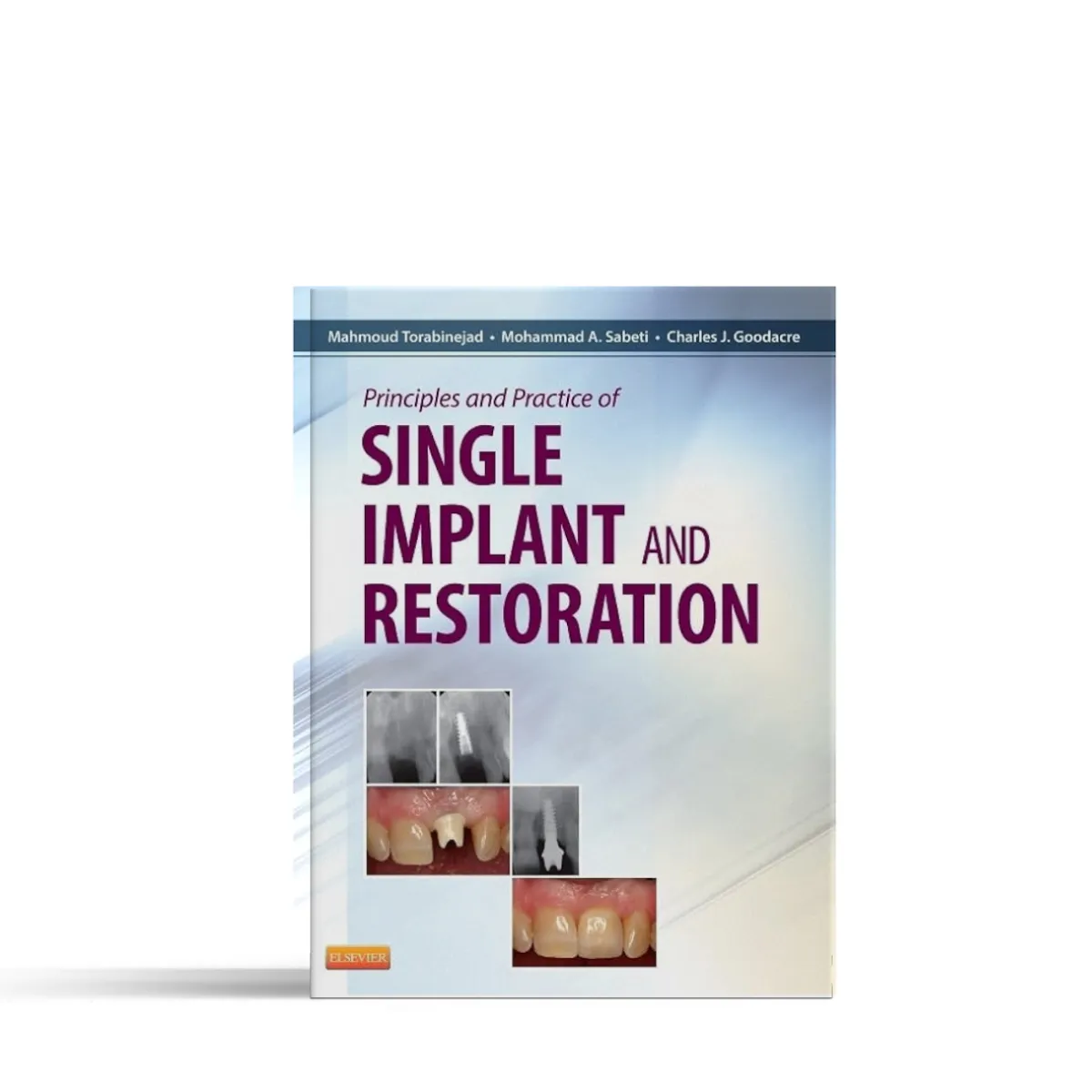 Principles & Practices Of Single Implant & Restoration 1st Edition (ISBN - 744763)