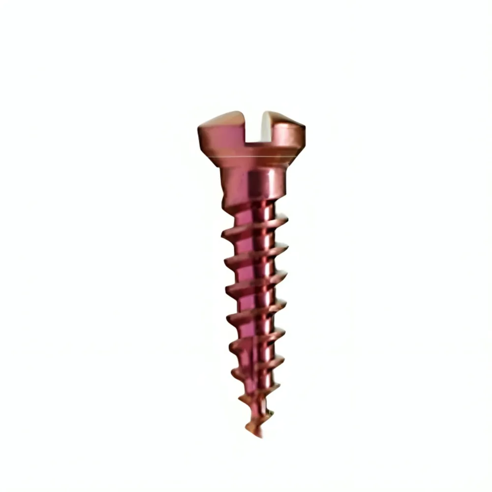 MCTBIO Titanium Bone Screw 1.6mm (Pack of 5)
