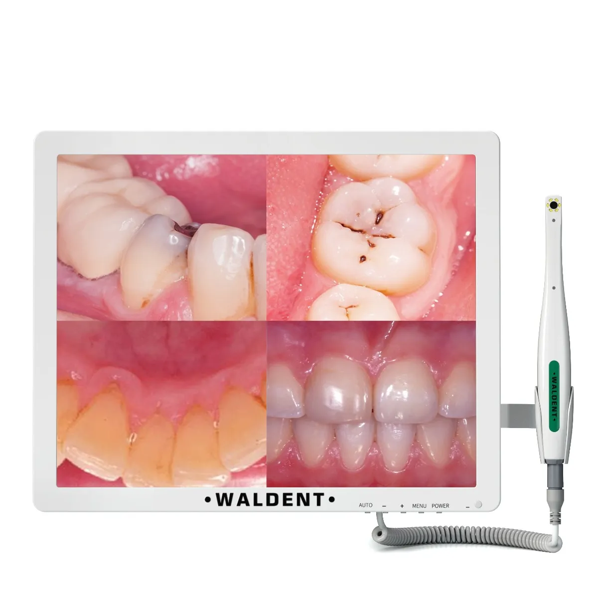 Waldent Intraoral Camera Smart -Cam with PMS