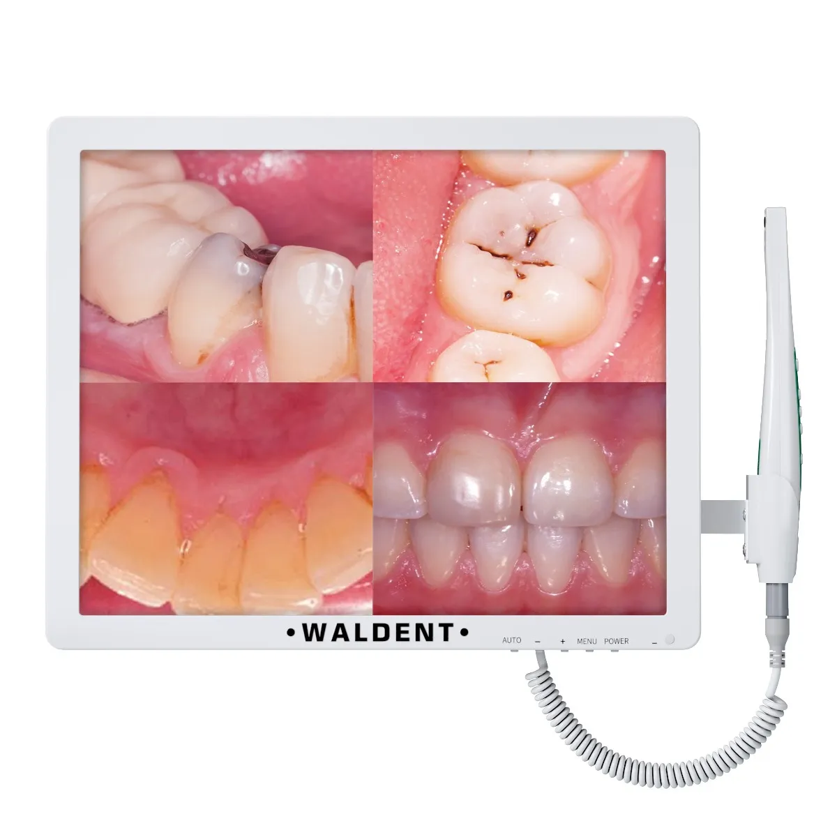 Waldent Intraoral Camera Smart -Cam with PMS