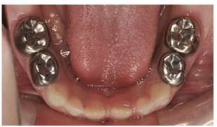 Colesterol Alto? Descubre La Forma Más Natural Y Eficaz De Bajarlo - Foto 5