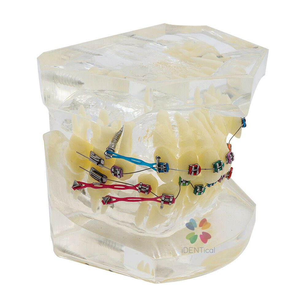 iDENTical Dental Orthodontic Models M3005