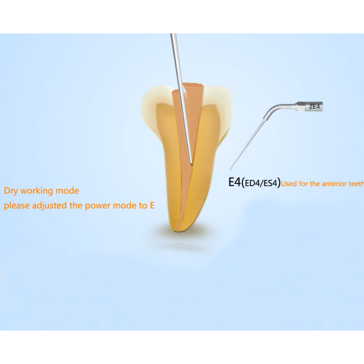 Woodpecker Scaler Tip E4 for UDS & EMS Scalers