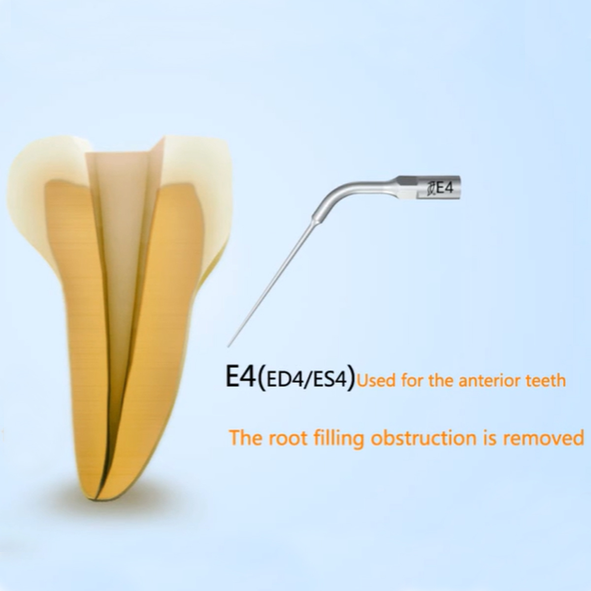 Woodpecker Scaler Tip E4 for UDS & EMS Scalers