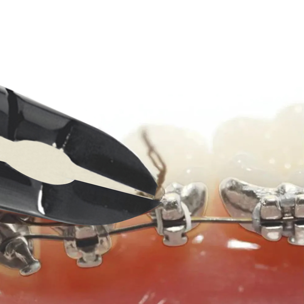 GDC Orthodontics Black Line Cutter - Pin Ligature (3200/708)