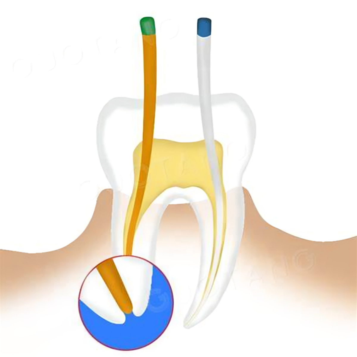 Waldent Paper Points Protaper (Length Marked) #F1-F3