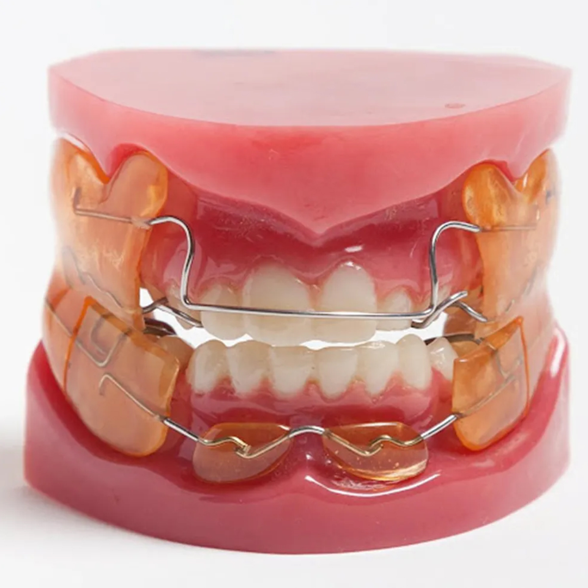 Dentomech Hard Steel Orthodontic Wire Spools 100g