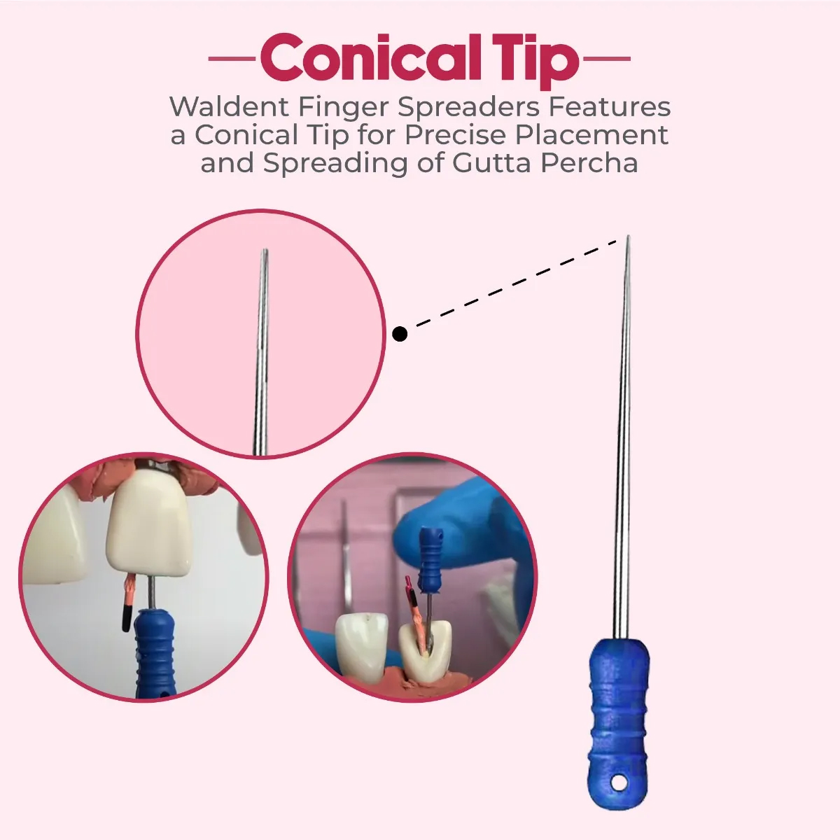 Waldent Finger Spreaders 21mm # 15-40 (Pack of 6)