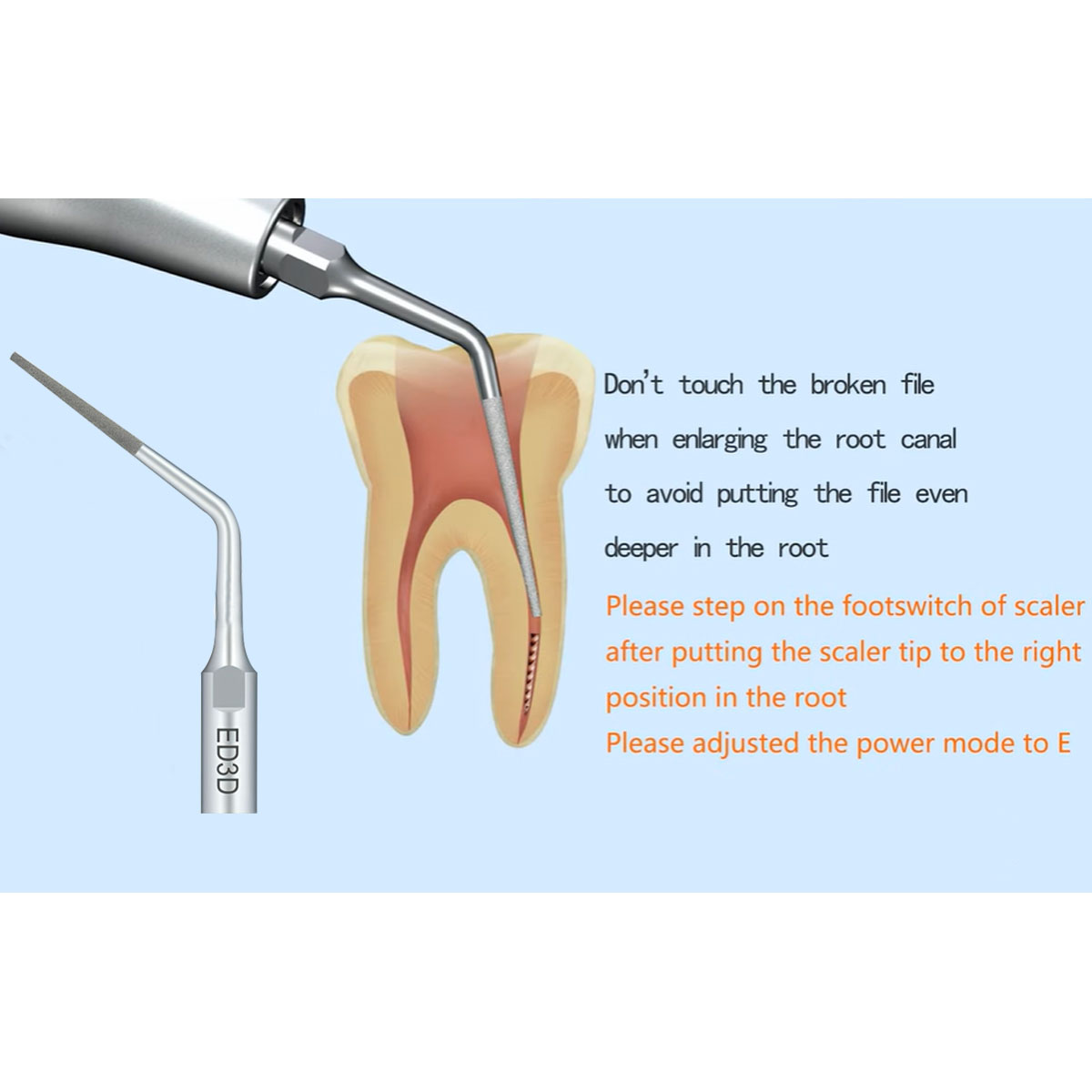 Woodpecker Scaler Tip ED3D for DTE & Satelec Scalers
