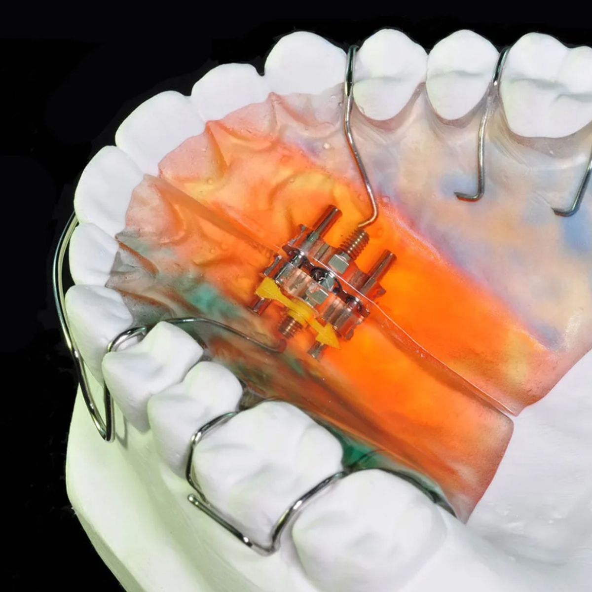 Dentomech Hard Steel Orthodontic Wire Spools 100g