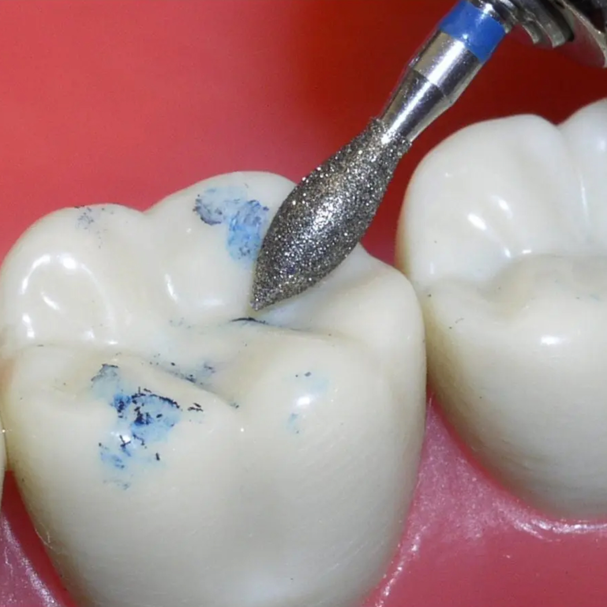 Pivo Crown Preparation Micromotor Burs Kit - Contra-Angle Handpiece (Set Of 7)