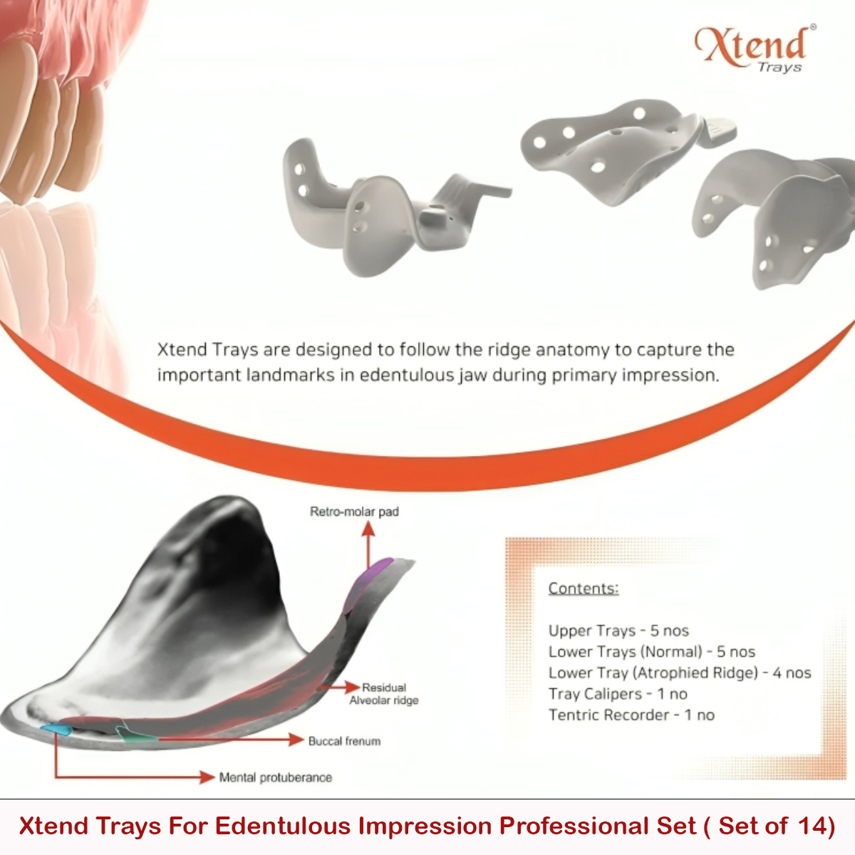 Delta Xtend Trays For Edentulous Impression Professional Set ( Set of 14)