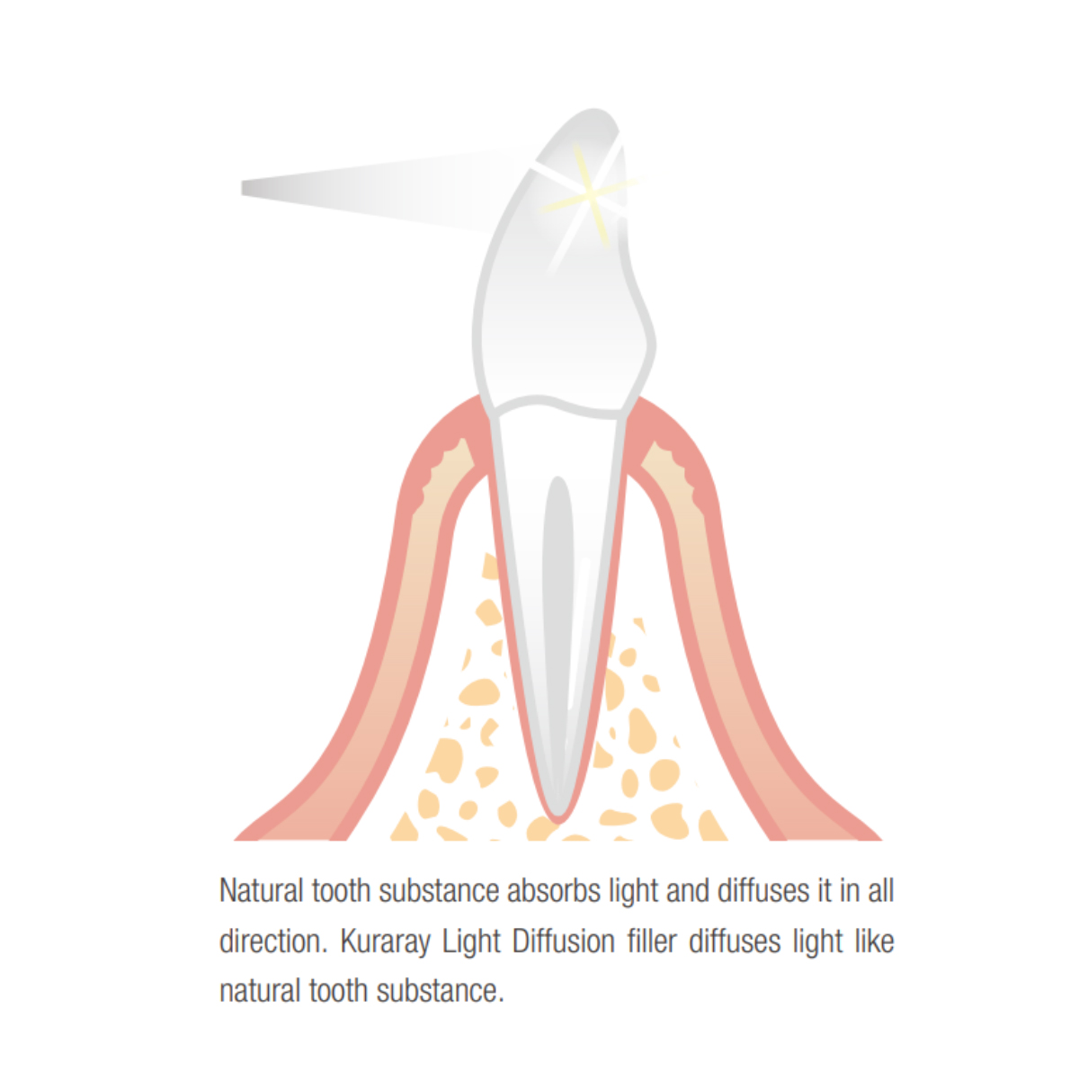 Kuraray Clearfil AP-X Esthetic Flow Flowable Composite Refills