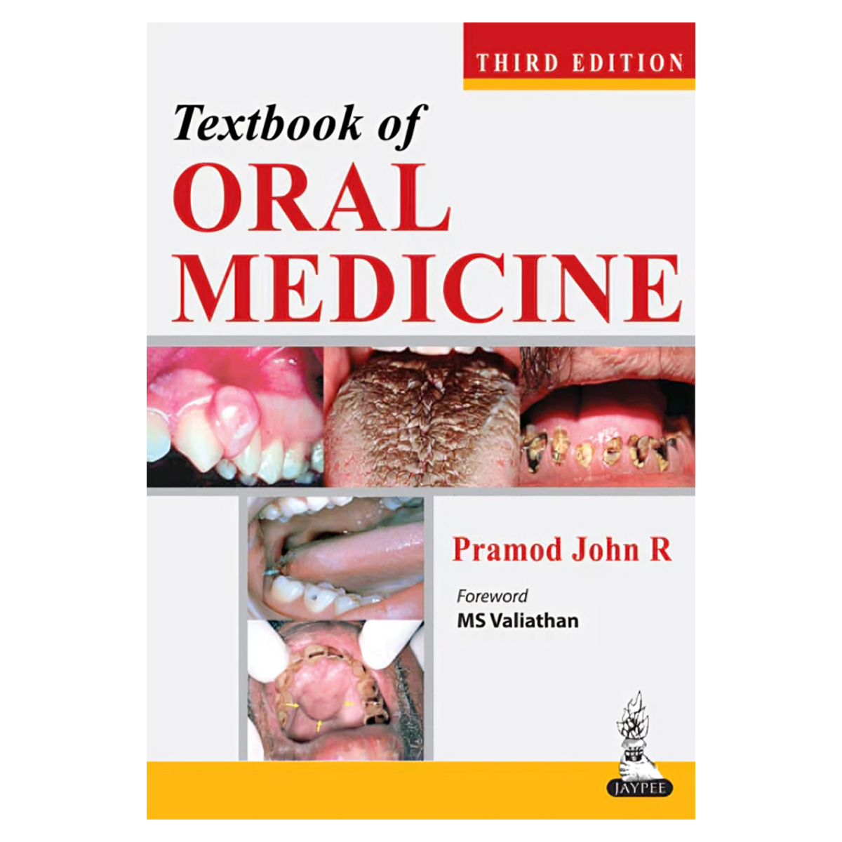 Jaypee Medical Textbook Of Oral Medicine 3rd Edition (ISBN - 908501)