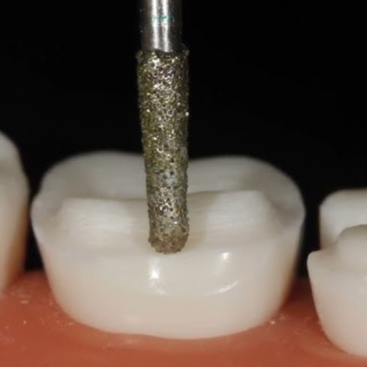 Pivo Inlay - Onlay Preparation Airotor Diamond Burs Kit (Set Of 10)