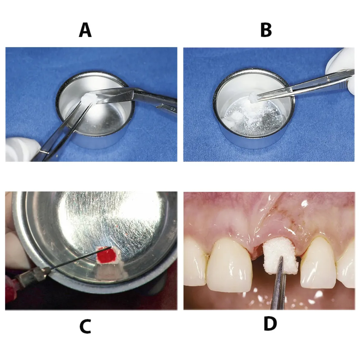 Geistlich Bio-Oss Collagen - 100mg