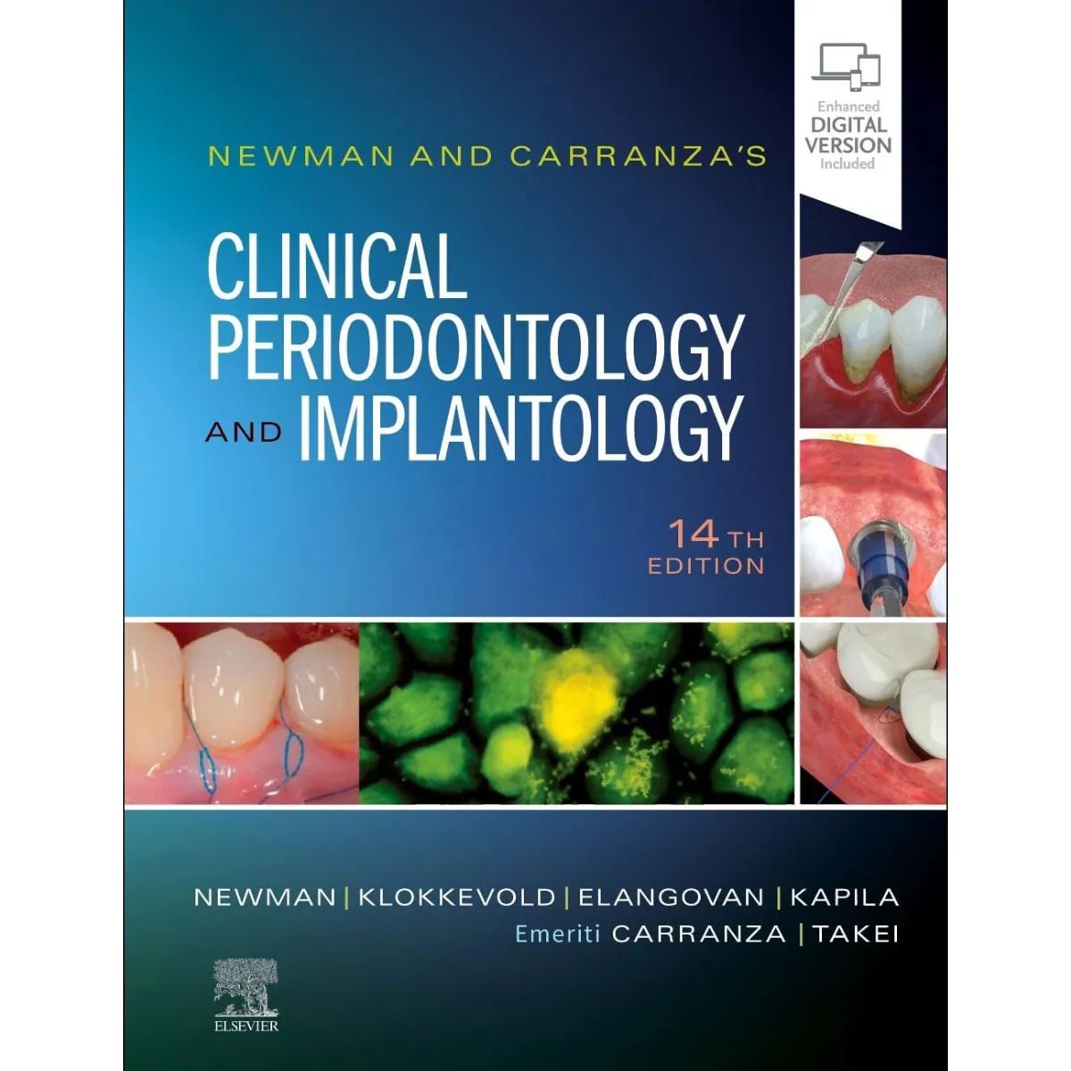 Newman And Carranza’s Clinical Periodontology and Implantology With Access Code 14th Edition (HB 2024)