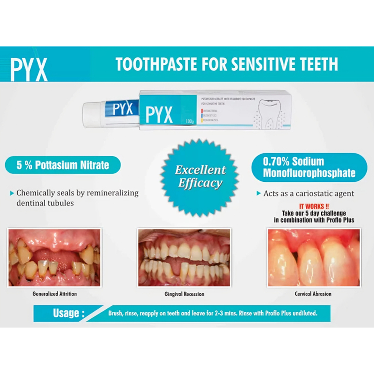 Sandika Pharma Pyx Toothpastes For Sensitive Teeth (Pack of 12)