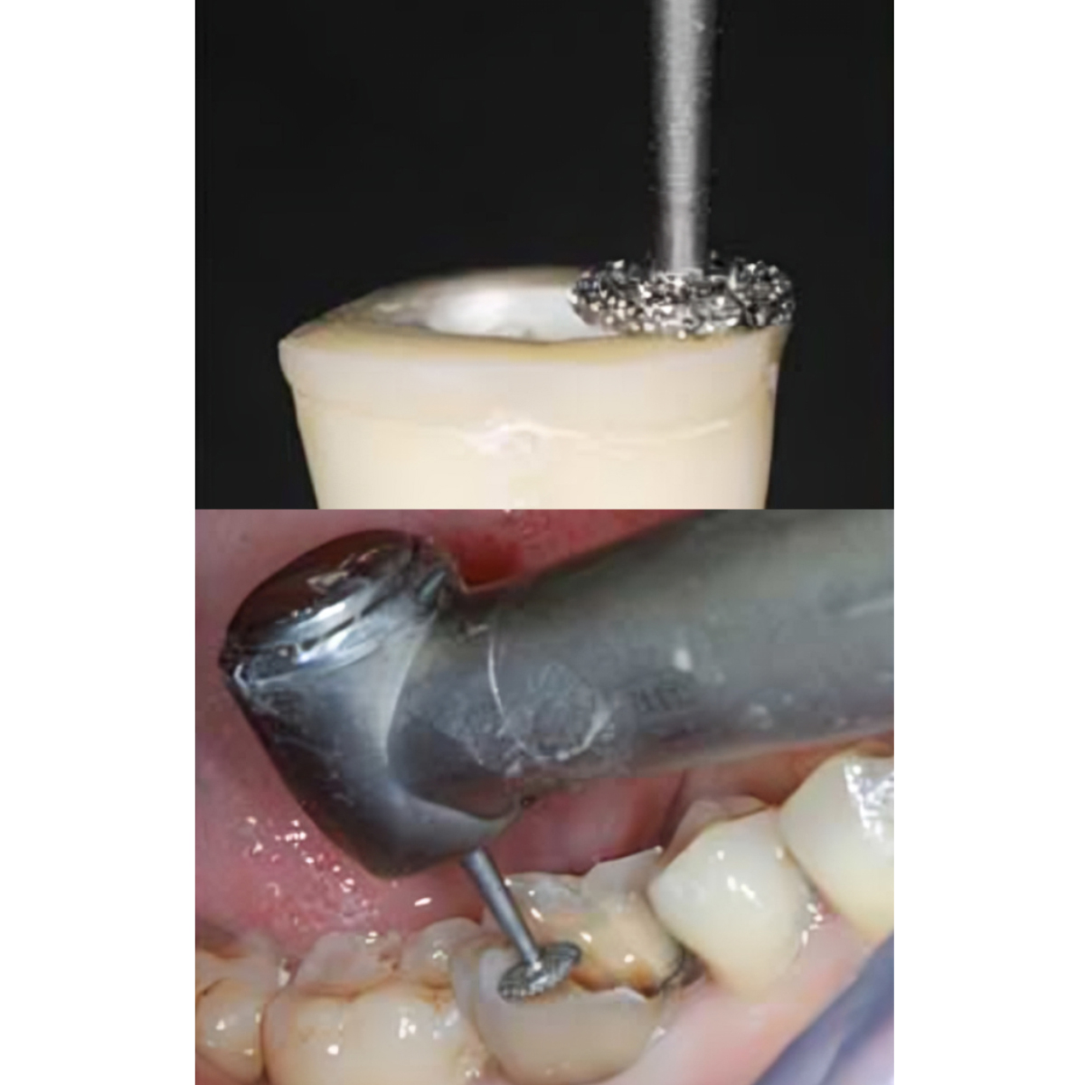 Pivo Wheel Round Contra-angle Diamond Bur CA - WR-13 (Pack Of 5)