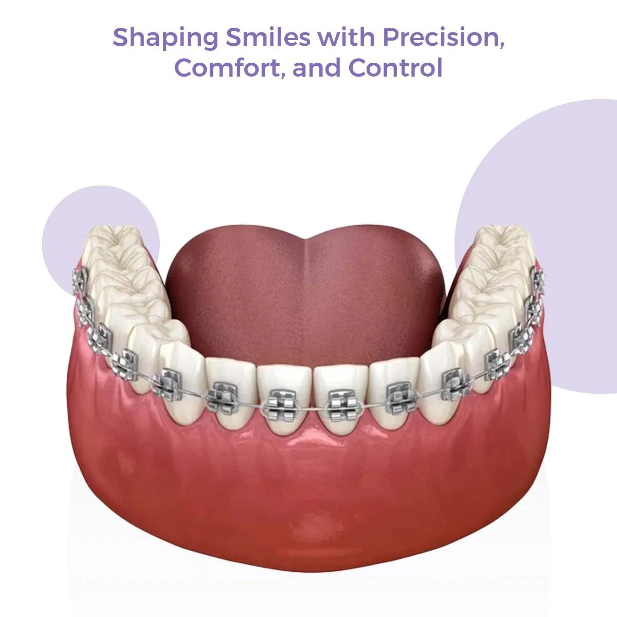 OrthoMetric Flexy NiTi Reverse Curve Intraoral Archwires - Square (10/Pk)