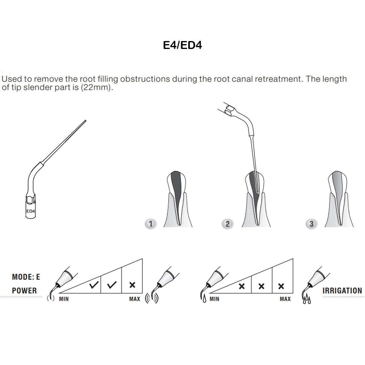 Woodpecker Scaler Tip ED4 for DTE & Satelec Scalers