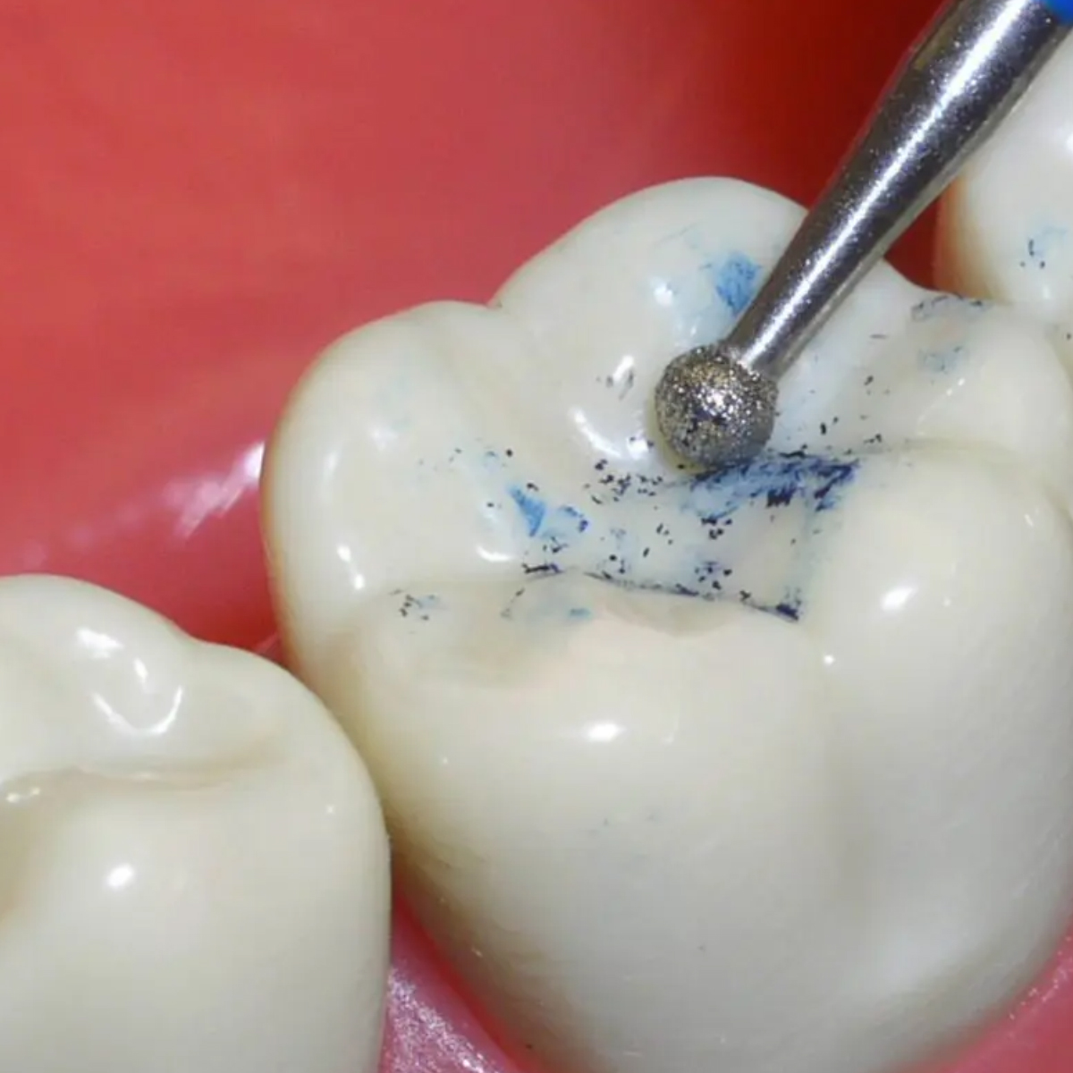 Pivo Micromotor Burs Kit - CA (Set Of 4)