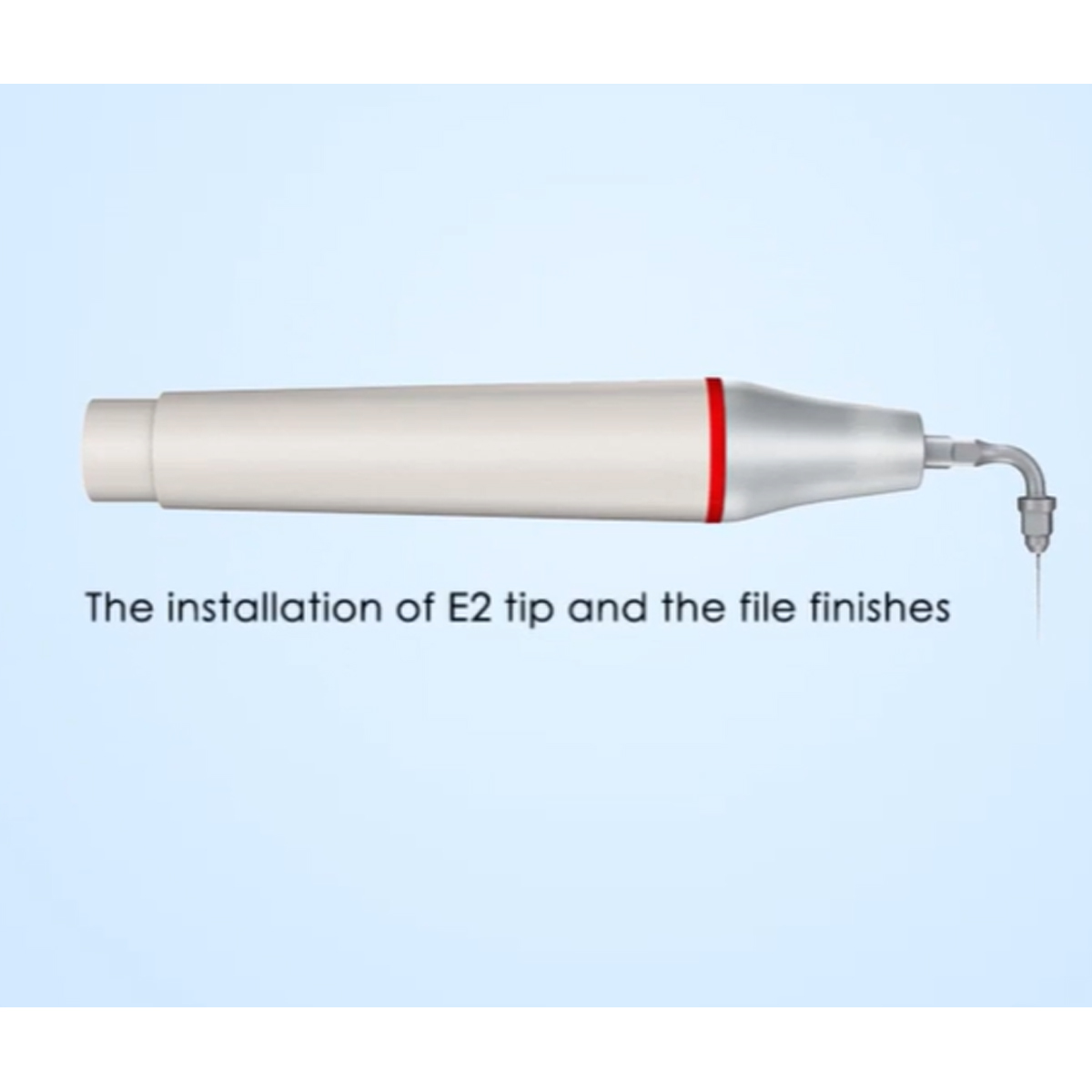 Woodpecker Scaler Tip E2 for UDS & EMS Scalers         