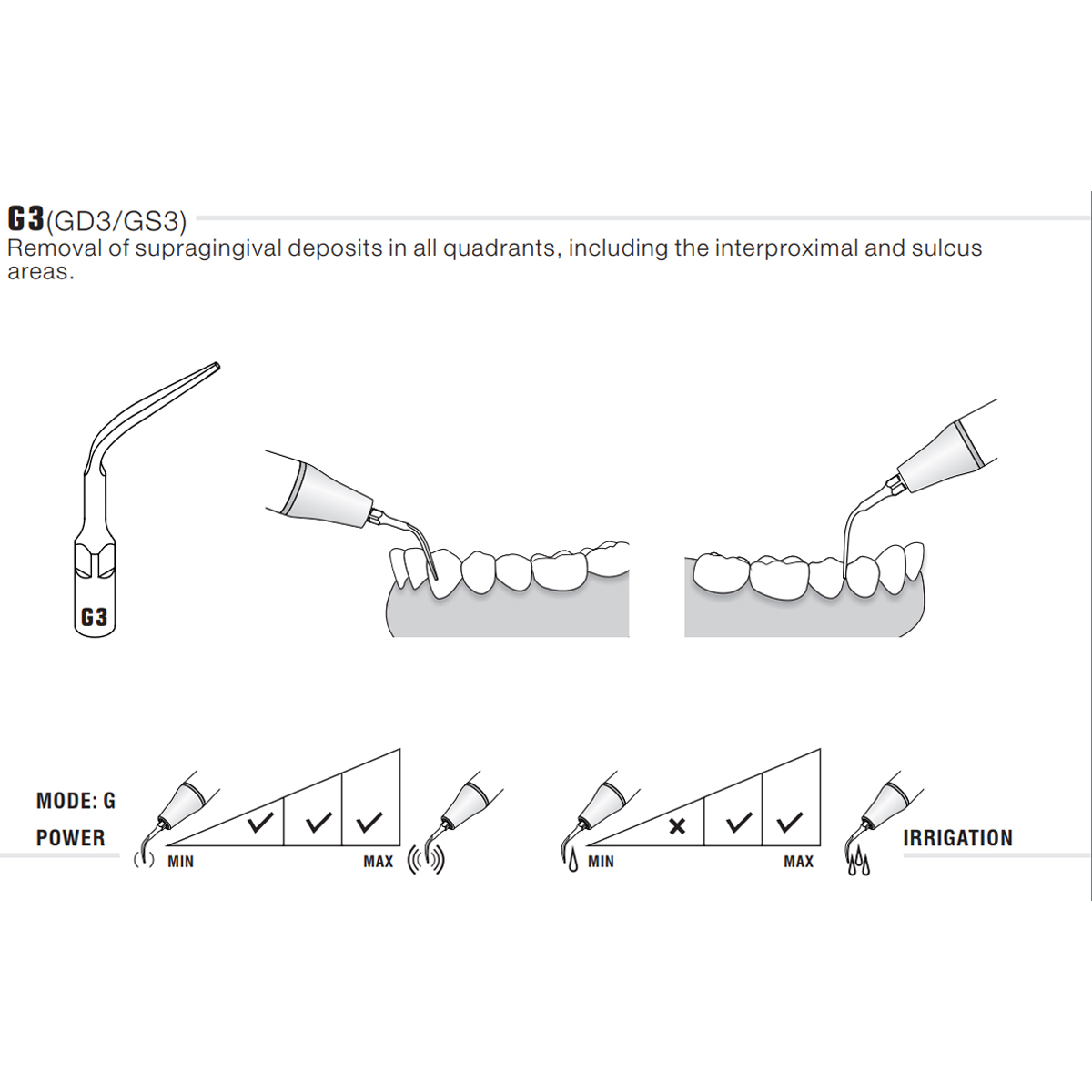 Woodpecker Scaler Tip G3 for UDS & EMS Scalers