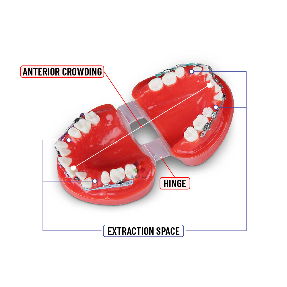 iDENTical Dental Orthodontic Models M3005