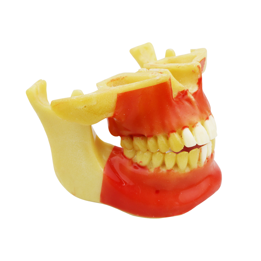 iDENTical Ortho Implant Practice with Soft Tissue Model M2031