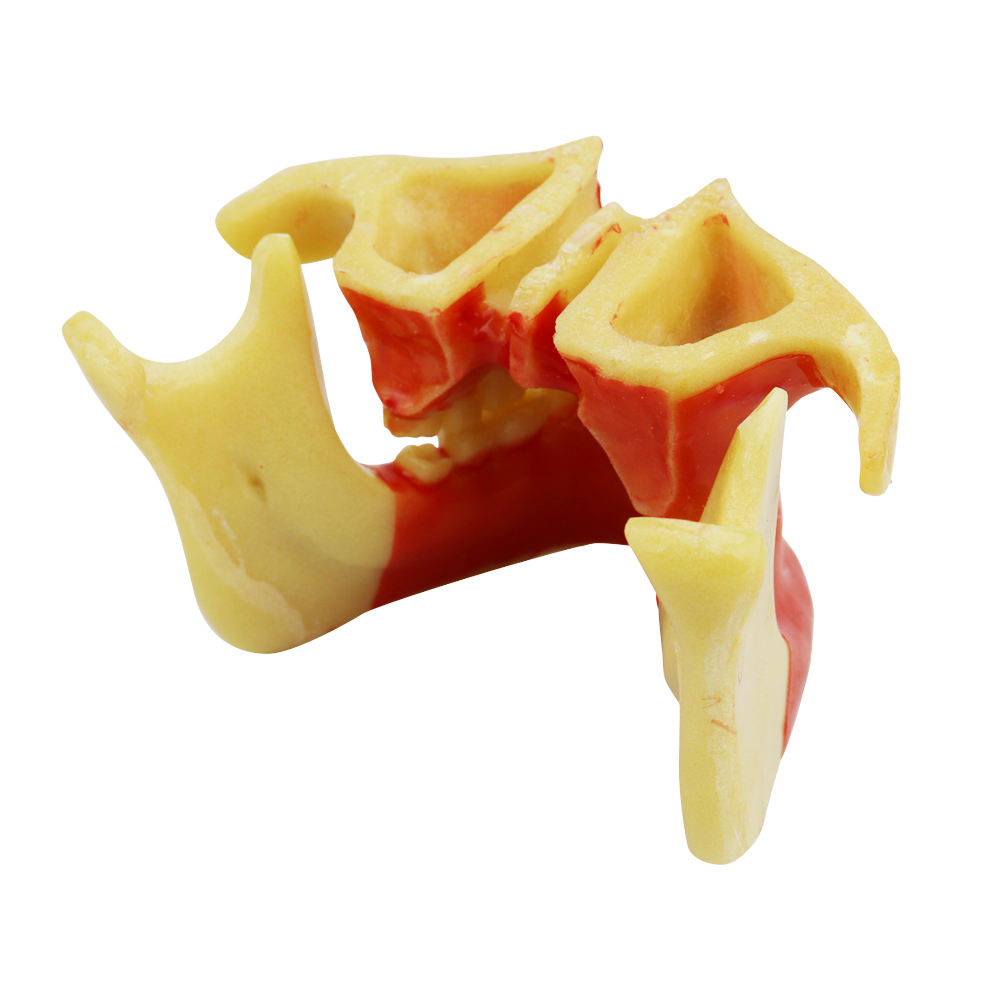 iDENTical Ortho Implant Practice with Soft Tissue Model M2031