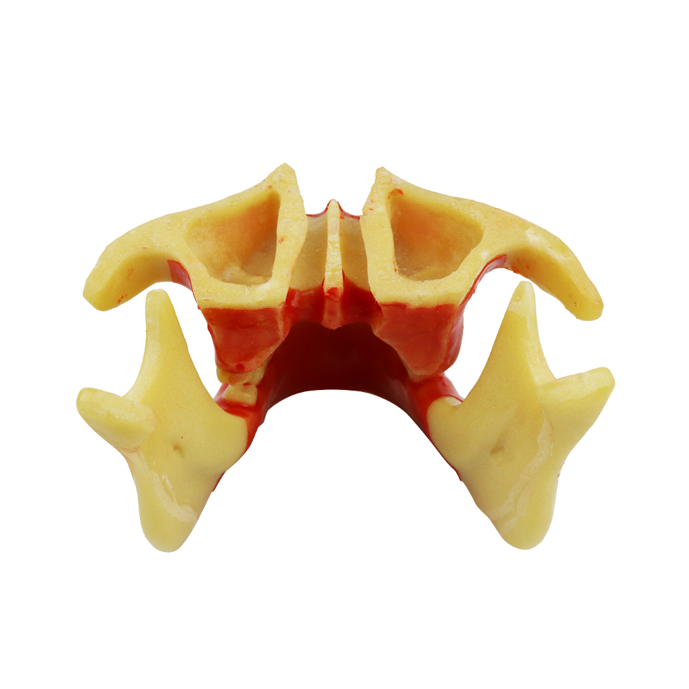 iDENTical Ortho Implant Practice with Soft Tissue Model M2031