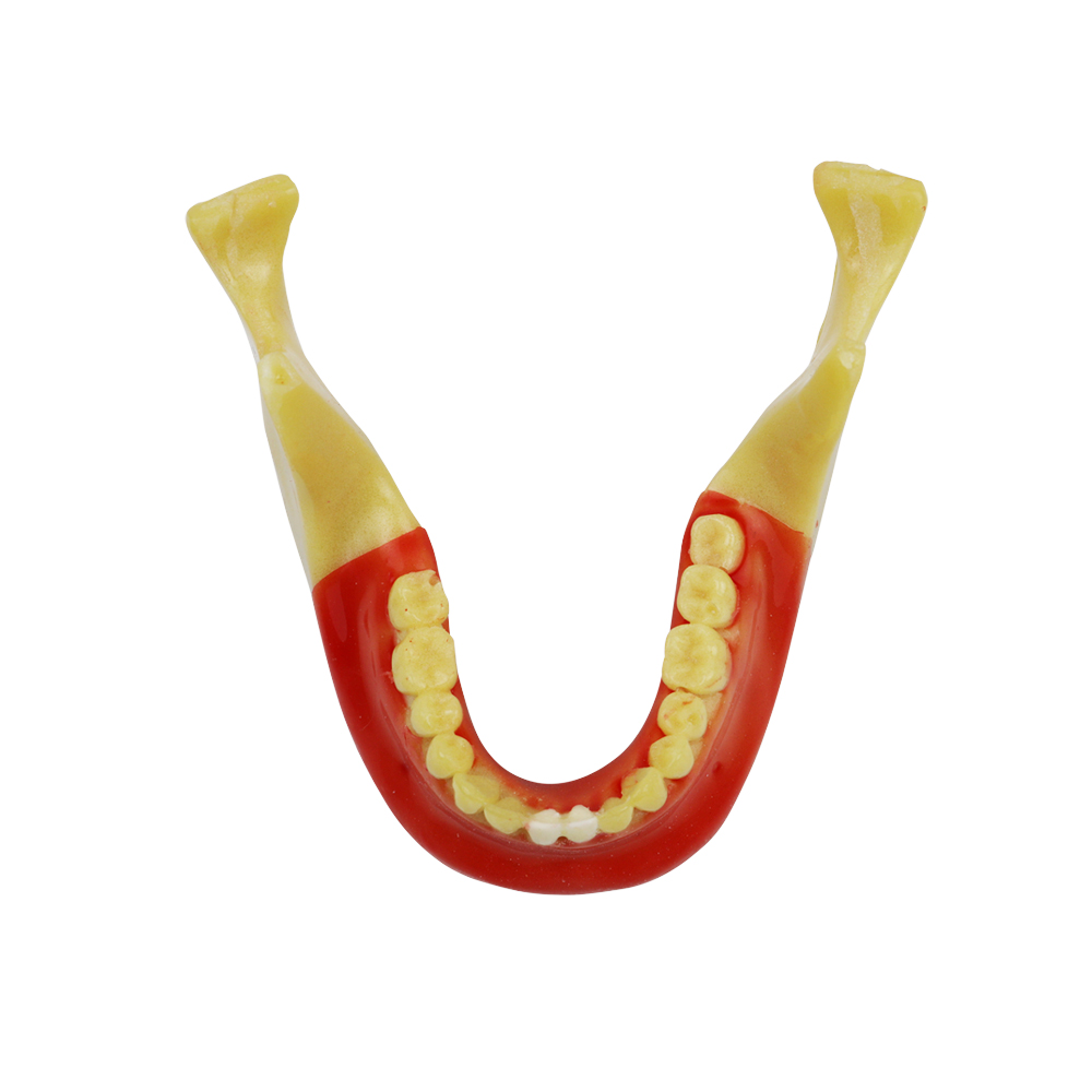 iDENTical Ortho Implant Practice with Soft Tissue Model M2031