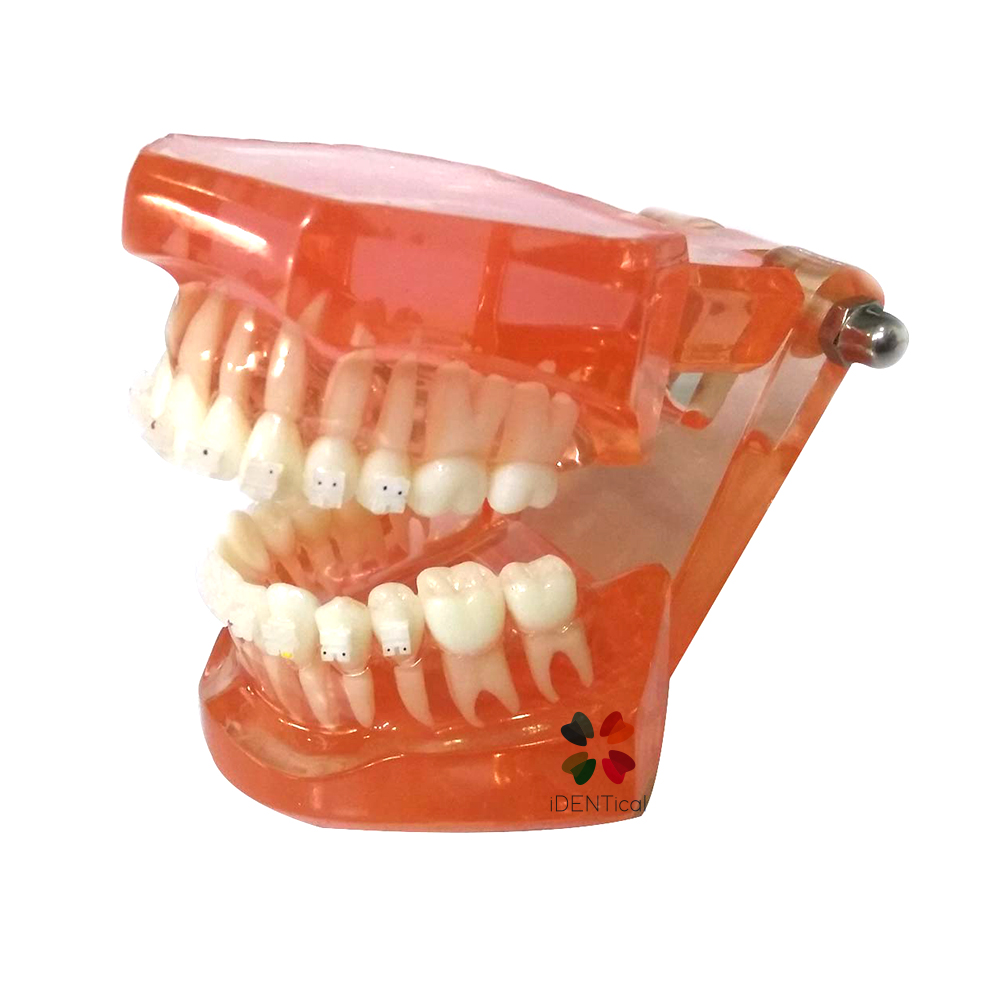 iDENTical Complete Ceramic Bracket Model MD-121