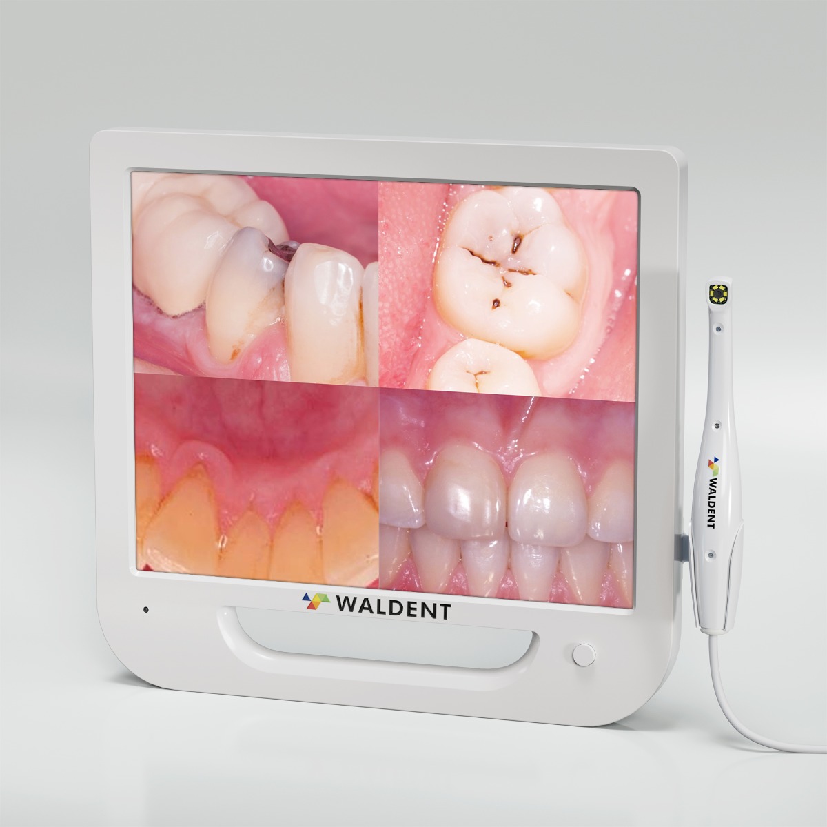 Waldent Intra Oral Camera with Screen - Ergo (10 MP)