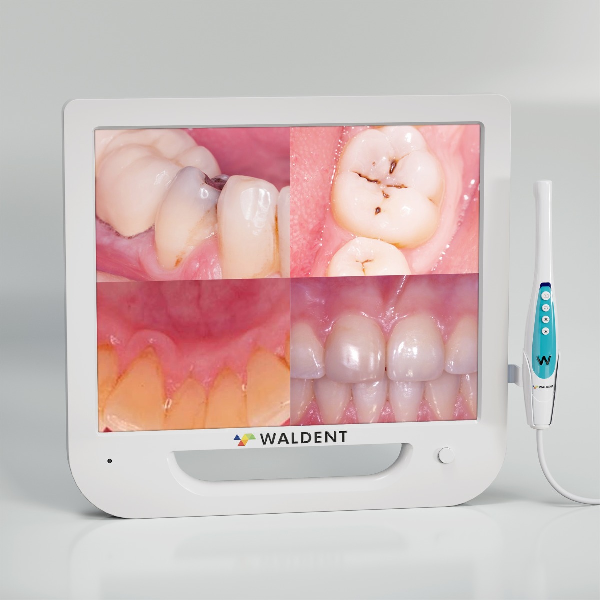 Waldent Intra Oral Camera with Screen - Ergo (10 MP)