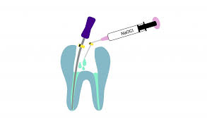 Waldent Sodium Hypochlorite 5% 