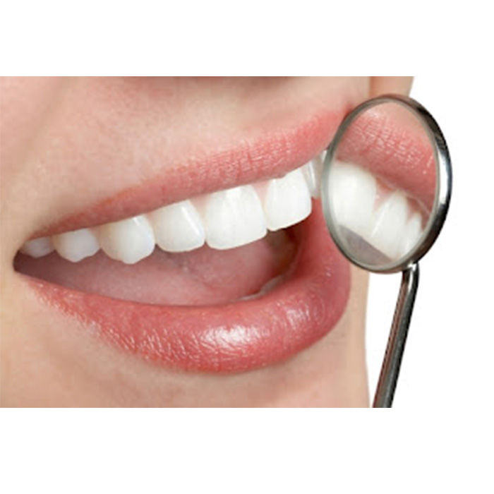 Waldent Mouth Mirror with Premium Handle (13/110)