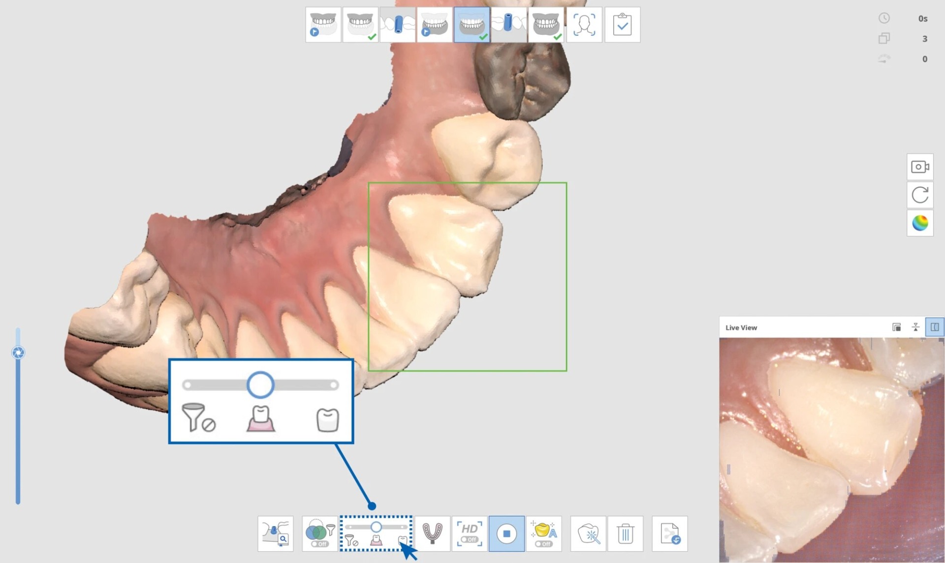 Medit i700 Intraoral Scanner