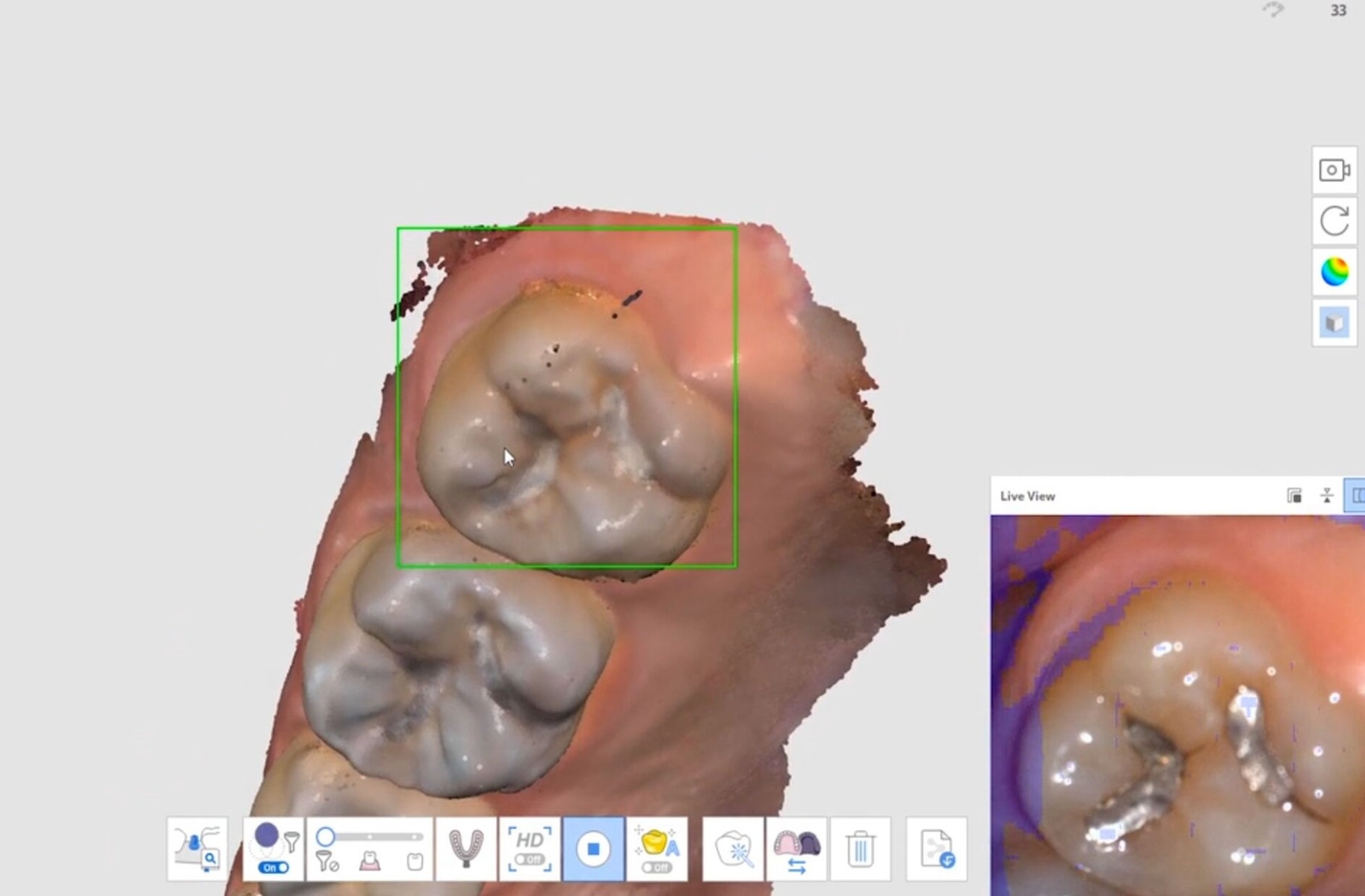 Medit i700 Intraoral Scanner