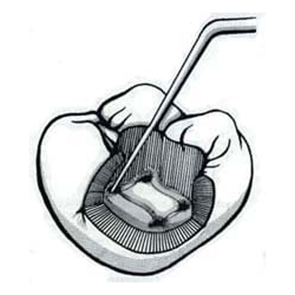 Waldent Endodontic Explorer DG 16 (15/725)