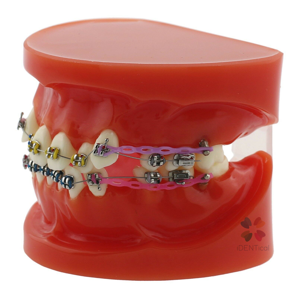 iDENTical Dental Orthodontic Models M3005