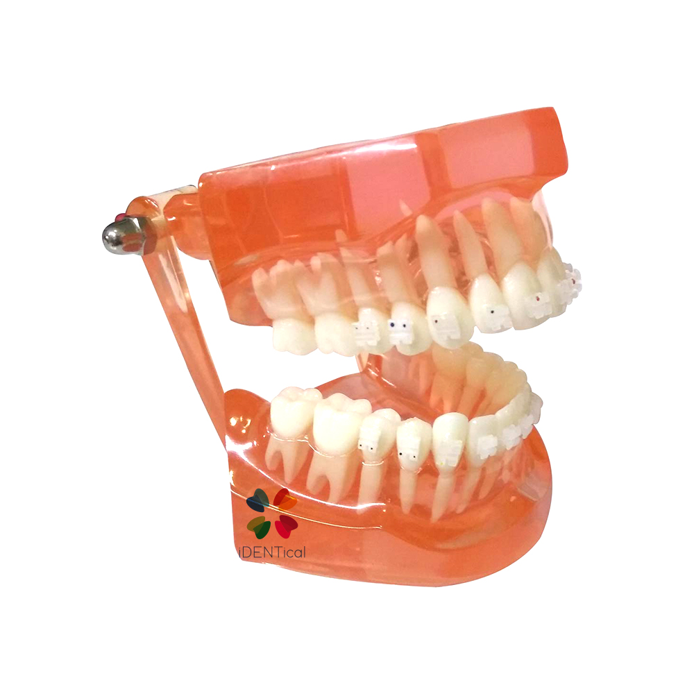 iDENTical Complete Ceramic Bracket Model MD-121