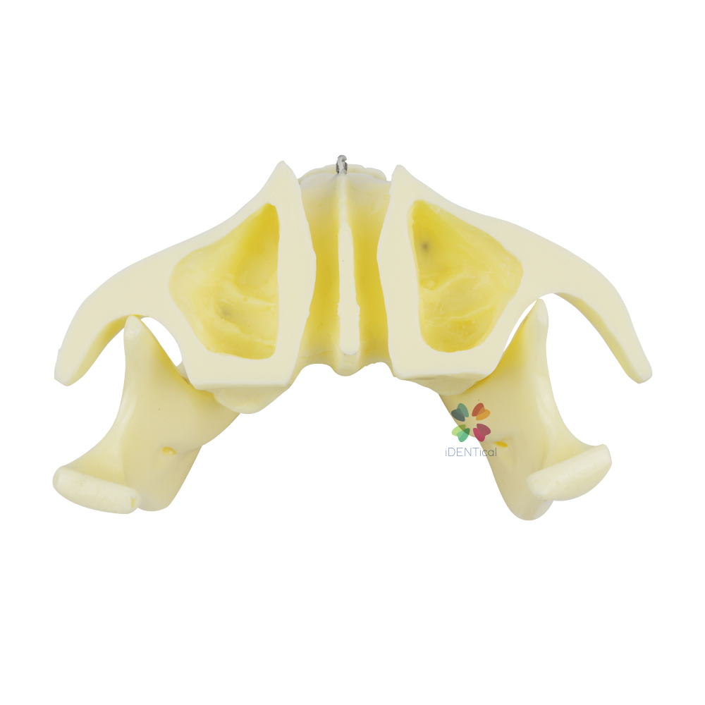 iDentical Orthodontic Implant Model - M2016